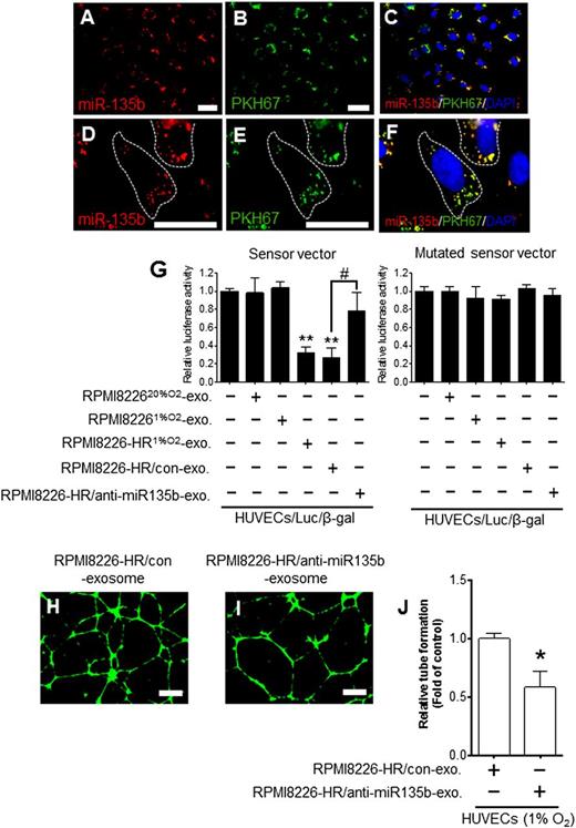 Figure 5. Transfer of miR-135b derived from HR-MM cells to HUVECs via exosomes. HUVECs/β-gal (HUVECs transfected with pMIR-reporter β-gal control vector) were cultured with PKH67-labeled exosomes derived from the parental cells (RPMI8226) transfected with Cy3-pre-miR-135b. The Cy3-miR-135b signals were detected in (A) the cytoplasm of HUVECs (red), and (B) green signals indicate PKH67-labeled exosomes. (C) Cy3-miR-135b signals are colocalized with PKH67 in HUVECs (yellow). Parts of areas in (A-C) are enlarged in (D-F), respectively. Nuclear counterstaining was performed using 4′,6-diamidino-2-phenylindole (DAPI) (blue). The scale bar indicates 10 µm. (G) Luciferase reporter vector for assessing miR-135b–specific activity contained complementary miR-135b sequences in its 3′-UTR. The normalized firefly luciferase activity was obtained by firefly luciferase activity/β-gal activity. Sensor vector: luciferase activity of HUVECs/Luc/β-gal (HUVECs cotransfected with luciferase reporter vector and β-gal control vector) treated with RPMI8226-HR1%O2-exosomes was significantly reduced compared with control (HUVECs/Luc/β-gal without exosomes) (**P < .01, n = 3). RPMI8226-HR/anti-miR135b exosomes (miR-135b–deactivated exosomes of RPMI8226-HR cells) could not reduce the luciferase activity in HUVECs (RPMI8226-HR/anti–miR135b-exo vs RPMI8226-HR/con-exo: #P < .01, Student t test, n = 3). In the mutated sensor vector, there was no difference in luciferase activity with or without exosomes. (H-I) Tube formation assay of HUVECs cultured under 1% O2 with RPMI8226-HR1%O2/control exosomes (H) and with RPMI8226-HR1%O2/anti-miR135b exosomes (I). The scale bar indicates 500 µm. (J) The tubelike structures determined by pixel density are reduced by the addition of RPMI8226-HR1%O2/anti-miR135b exosomes compared with control (*P < .05 vs control, Student t test, n = 3). Values are means ± SD of 3 independent experiments, with each performed on a different day. exo, exosome; con, control.