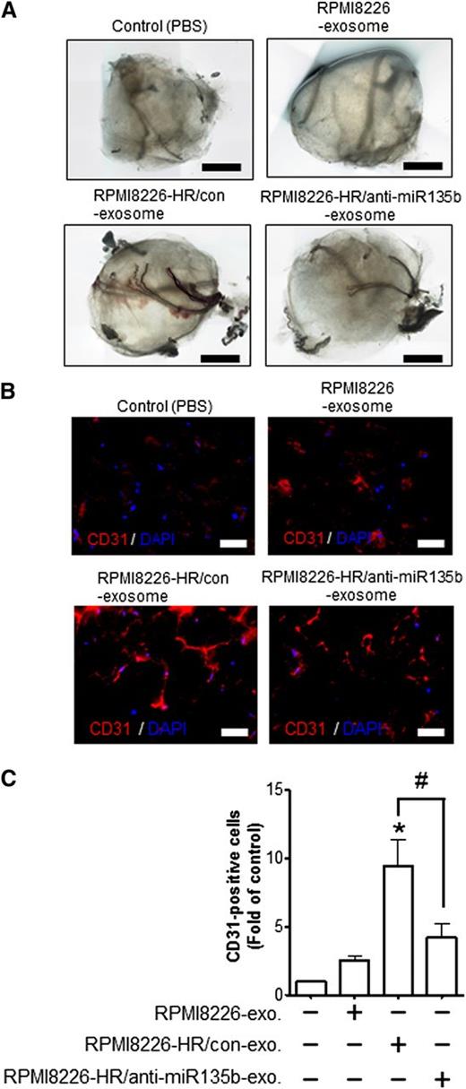 Figure 6. Exosomal miR-135b enhances neovascularization in vivo. (A) Representative light microscopic photographs of Matrigel plugs harvested 1 week after subcutaneous injection into nude mice. The exosomes derived from RPMI8226, RPMI8226-HR/control, RPMI8226-HR/anti-miR135b, or phosphate-buffered saline (as a vehicle control) were mixed with growth factor–reduced Matrigel. (B) The neovasculature induced by the exosome of RPMI8226-HR cells in Matrigel was visualized by immunohistochemical staining of frozen sections with anti-mouse CD31 antibody. Representative photographs reveal abundant vasculature positively stained for CD31 (red). Nuclear counterstaining was performed using DAPI (blue). The scale bar indicates 200 µm. (C) Quantitative data for the neovessels lined in Matrigel plugs determined by pixel density. The exosome derived from RPMI8226-HR cells increased the density of vasculature positive for CD31 in Matrigel plugs compared with vehicle control (*P < .01 vs control, Student t test). The HR exosome–induced increase of neoangiogenesis was canceled by anti–miR-135b disrupting the activity of exosomal miR-135b (RPMI8226-HR/con-exo vs RPMI8226-HR/anti-miR135b-exo; #P < .05, Student t test). Values are mean ± SD. exo, exosome; con, control.