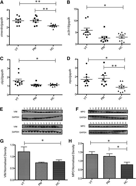 Figure 1. Validation of protein targets identified by 2D DIGE. Ex vivo monocytes were treated with 200 µg/mL of individual IgG samples: 10 VT, 8 PM, or 10 HC for 6 hours and levels of mRNA measured by qPCR (A-D). Data points represent the fold change expression of each sample compared with untreated; mean of duplicates and standard errors are displayed. Data are representative of at least 3 independent experiments. Representative western blots of monocytes treated with the 10 VT, 8 PM, and 10 HC IgG samples are shown (E-F). Blots were scanned and analyzed densitometrically. Graphical representations of the density ratios of each protein and GAPDH expressed in arbitrary scanning units are displayed (G-H). Data are representative of at least 2 independent biological replicates. Statistically significant difference (*P < .05, **P < .005) was determined by ANOVA. 2D, 2-dimensional; ANOVA, analysis of variance; GAPDH, glyceraldehyde-3-phosphate dehydrogenase; qPCR, quantitative PCR.