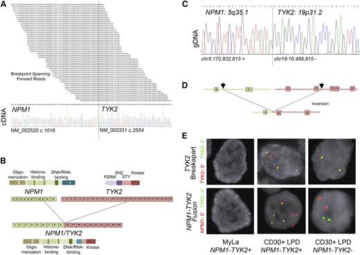 Figure 1. Identification of TYK2 translocations in cutaneous T-cell lymphoma–derived cell line and primary CD30 positive LPD patient samples. (A) Read support from RNA sequencing illustrating the forward fragment reads spanning the breakpoint between the 5′ NPM1 (NM_002520 c.1016) component and the 3′ TYK2 (NM_003331 c.2554) component and confirmation by Sanger sequencing. (B) Protein domain and exon diagram illustrating the preservation of N-terminal oligomerization and histone and DNA/RNA binding domains of NPM1 and the C-terminal pseudokinase (STY) and kinase domains of TYK2 in the NPM1-TYK2 fusion protein. (C) Cloning of the genomic breakpoint of the t(5;19) fusion event at chr5:170 832,813 and chr19:10 469,815 and confirmation by Sanger sequencing. (D) The NPM1-TYK2 fusion joins the positive strand of the NPM1 locus up to and including exon 9, with the inverted negative strand of the TYK2 locus between exons 15 and 16. (E) FISH studies. A TYK2 break-apart assay shows a TYK2 rearrangement in the MyLa cell line and in a primary cutaneous CD30-positive LPD (upper panel). NPM1-TYK2 fusion FISH reveals that NPM1 is the partner gene in both. A case that is negative for TYK2 translocation is also illustrated (lower panel).