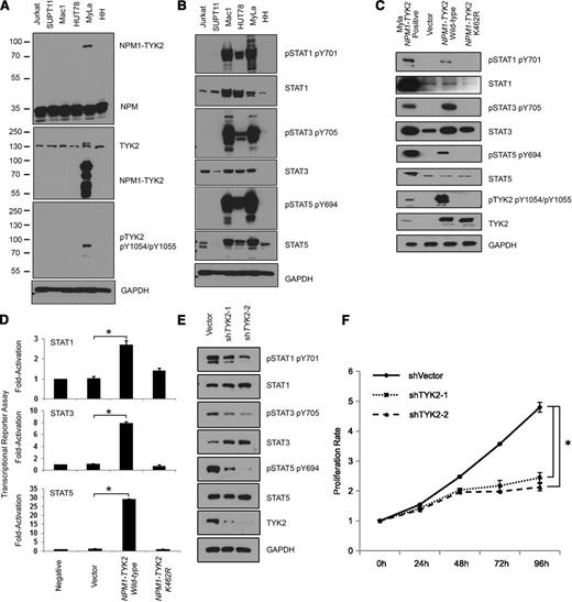 Figure 2. Oncogenic potential of NPM1-TYK2 fusion gene product. (A) Presence of the NPM1-TYK2 fusion protein in MyLa and not in other T-cell lines. Individual NPM1 and TYK2 western blot assays show shift in the size of the protein in MyLa as a result of the fusion. (B) Hyperactivation of TYK2 and elevated STAT pathway activation in MyLa cells endogenously expressing NPM1-TYK2 fusion protein as compared with other T-cell lines. The Mac1 cell line that has a JAK2 rearrangement is used as a positive control. The HUT78 cell line exhibits constitutive STAT5 activation. (C) Ectopic expression of NPM1-TYK2 fusion protein in HEK293FT cells reveals activation of STAT proteins in western blot assays. Note the significantly reduced levels of STAT activation in cells expressing NPM1-TYK2 kinase-defective mutant K462R. (D) Exogenously expressed NPM1-TYK2 fusion protein in HEK293FT cells leads to transcriptional activation of STAT1/3/5. Cells expressing kinase-defective mutant K462R NPM1-TYK2 fusion protein show reduced levels of STAT activation indicating a specific effect of TYK2 kinase activity on downstream STAT activation. (E) Diminished STAT pathway activation following knockdown of TYK2 protein in MyLa cell line by shRNA knockdown. (F) shRNA-mediated silencing of TYK2 reduces proliferation of MyLa cells, demonstrating oncogenic potential of NPM1-TYK2. GAPDH, glyceraldehyde-3-phosphate dehydrogenase.