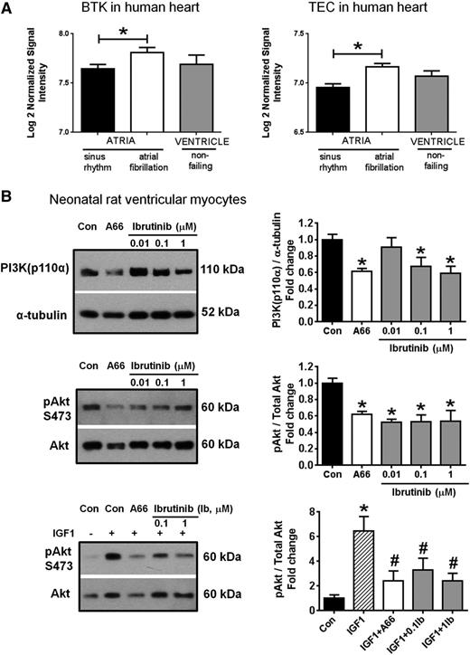 Figure 1. Expression of BTK and TEC in the human heart, and the effect of ibrutinib on activation of the PI3K-Akt pathway in NRVM. (A) Gene expression of BTK and TEC in human atrial and ventricular tissue. Data are expressed as mean ± standard error of the mean. Atrial samples: sinus rhythm (N = 20), AF (N = 10); ventricle (N = 5). *P < .05. Unpaired Student t-test. Data obtained from microarray deposited at http://www.ncbi.nlm.nih.gov/geo/, accession number GSE2240. (B) The effect of ibrutinib treatment on PI3K(p110α) protein expression and/or pAkt/total Akt in NRVM under (1) basal conditions (top 2 panels), and (2) in the presence of insulin-like growth factor 1 (IGF1, 10 nM, +, bottom panel). A66 (10 µM), specific inhibitor of PI3K(p110α), was administered alone (top 2 panels) or together with IGF1 (bottom panel). Data are expressed as mean ± standard error of the mean of triplicates (under basal conditions, results are representative of 3 independent NRVM preparations). *P < .05 vs control (Con); #P < .05 vs IGF1. Analysis of variance followed by Fisher’s post-hoc tests. Ib, ibrutinib.