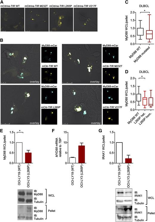 Figure 3. Aggregation of constitutively active lymphoma-associated TIR mutants in lymphoma cell lines. (A-B) HEK293 cells were transfected with plasmids for mCitrine-TIR (yellow pseudocolor) or mutants and full-length MyD88-mCerulean (blue pseudocolor, B). Twenty-four hours later, cells were fixed and visualized under the confocal microscope at ×1000 magnification. Shown are representative confocal images of at least 3 independent experiments. (C-G) Augmented amount of MyD88 in aggregates in different DLBCL cell lines. Cell lysates were fractionated by centrifugation and lysate and pellet fraction analyzed by SDS-PAGE followed by anti-MyD88 (C-E) or IRAK1 (G) and anti-tubulin immunoblot (see blots in panels E and G). Relative MyD88 or IRAK1 and tubulin levels were quantified by charge-coupled device detection and plotted as the tubulin-normalized ratios of lysate (WCL) vs pellet MyD88 or IRAK1. (C-D) Data were combined from 9 experiments and are shown as min-to-max box-and-whisker plots. In panel C, WT MyD88 DLBCL cell lines (white, OCI-LY19, BJAB, U2392) were compared with MyD88-mutated cell lines (burgundy, OCI-LY10, TMD8, HBL1, OCI-LY3 with L265P; HLY1 with S119C, SUDHL2 with S122R). In panel D, cells were plotted according to L265P mutational status. White, WT MyD88 (OCI-LY19, BJAB, U2392); red, L265P heterozygous (OCI-LY10, TMD8, HBL1); burgundy, L265P homozygous (OCI-LY3). (E) Comparison of unmutated OCI-LY19 (white) vs L265P homozygous OCI-LY3 (red) lysate vs pellet ratio from 9 combined experiments and showing a representative immunoblot. (F) Differences in MyD88 lysate expression in L265P-mutated OCI-LY3 cells are not due to lower mRNA expression as assessed by quantitative PCR in OCI-LY19 (white) and OCI-LY3 (burgundy) cells. One representative of 3 independent experiments was done in triplicate (mean + upper limit). (G) MyD88-containing aggregates also contain IRAK1. Comparison of unmutated OCI-LY19 (white) vs L265P homozygous OCI-LY3 (red) lysate vs pellet ratio from 3 combined experiments and showing a representative immunoblot. IB, immunoblot; WCL, whole-cell lysate.