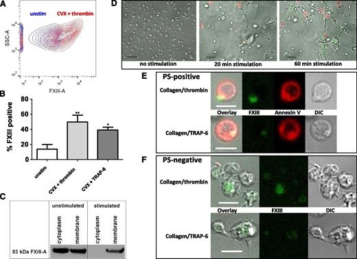 Figure 5. Activated platelets expose FXIII-A on their membrane surface. (A-B) Washed platelets were incubated with FITC-labeled anti-FXIII-A antibody and were left unstimulated (unstim) or stimulated with CVX (100 ng/mL) and TRAP-6 (20 μM) or thrombin (100 nM) for 45 minutes at room temperature before analyzing the number of positive cells by flow cytometry. (A) Representative contour plot showing side scatter (SSC-A) against FXIII-A-intensity or (B) mean data with standard error of the mean (SEM) from 4 experiments. *P < .05; **P < .01 vs unstimulated platelets. (C) Prior to fractionation, platelets were left unstimulated or were stimulated for 45 minutes at 37°C with 200 μM TRAP-6/200 μg/mL collagen. FXIII-A antigen was detected in the membrane and cytoplasm fractions by western blotting. Data are representative of 2 experiments. (D) Washed platelets (5 × 107/mL) were left unstimulated or were activated with 20 μg/mL collagen/20 μM TRAP-6 and stained using FITC-labeled anti-FXIII-A antibody (green) and Alexa-fluor647 Annexin-V to detect phosphatidylserine (red). Scale bar represents 10 μm. (E) PS and FXIII-A co-expressing platelets stimulated by 20 μg/mL collagen/20 μM TRAP-6 or 20 μg/mL collagen/100 nM thrombin. Differential interference contrast (DIC) image is shown and the scale bar represents 5 μm. Results are representative of 4 experiments. (F) PS-negative platelets stimulated with 20 μg/mL collagen/20 μM TRAP-6 or 20 μg/mL collagen/100 nM thrombin. Scale bar represents 5 μm. Results are representative of 4 experiments. (D-F) Images were obtained with a Zeiss LSM710 confocal microscope with a 63 × 1.40 oil immersion objective and were analyzed using Zen 2012 software.