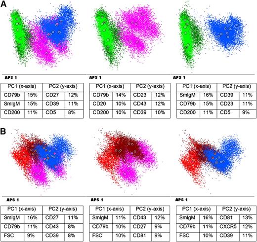 Figure 2. Immunophenotype of B-PLL patients vs CLL patients and MCL patients (A) APS view of B-PLL patients vs CLL. (B) APS view of B-PLL patients vs MCL. Blue: B-PLL with t(11;14); purple: B-PLL without t(11;14);brown: MCL (obtained from BM/PB); red: MCL obtained from LN); green: CLL. Below each APS plot the most informative markers for the first (PC1) and second (PC2) PC are shown. FSC: forward scatter.