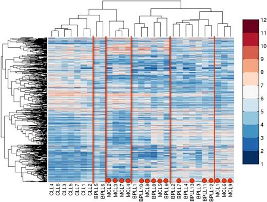 Figure 4. Unsupervised cluster analysis of gene-expression profiling data from B-PLL, MCL, and CLL patients. Red dots indicate a positive translocation t(11;14) status. T = 0.7; 2059 probe sets.