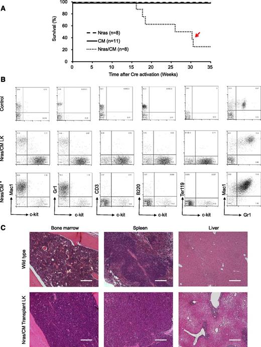 Figure 4. Characterization of donor cell–induced leukemia. (A) Kaplan-Meier survival curve of recipient mice transplanted with Nras (dash), CM (solid), and Nras/CM (dotted) BM cells and Cre-activated after 2 weeks. The red arrow depicts the disease onset of a mouse with mixed leukemic and myeloproliferative cells. (B) FACS analysis of peripheral blood cells from control (top), representative leukemic moribund Nras/CM recipient mice (5/6), and the Nras/CM* (bottom) mouse with a mix of leukemia and myeloproliferative phenotypes. (C) Representative H&E-stained histology sections of BM, spleen, and liver from control and moribund Nras/CM recipient mice (Nras/CM transplantation LK). The scale bars in the BM and spleen represent 50 μm; in the liver 100 μm.