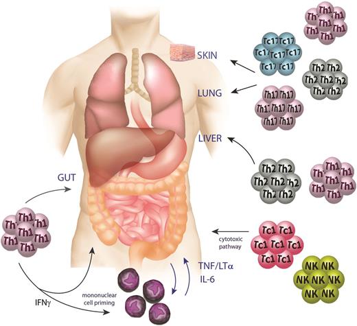 Figure 3. GVHD pathophysiology phase 3: the effector phase. During the effector phase of GVHD, inflammatory cytokines (IFNγ, TNF, lymphotoxin, and IL-6) derived from macrophages and T cells mediate apoptosis in target tissues, particularly within the gut. Donor Th1/Tc1, Th2/Tc2, and Th17/Tc17 cells elicit GVHD with relatively tissue-specific patterns mediated in part by their respective chemokine profiles and the relative sensitivity of the target to effector cytokines generated by each lineage. Cytolytic T and NK cells mediate antigen-dependent killing of target tissues via the perforin/granzyme and TNF member pathways.