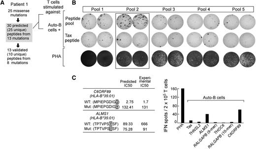 Figure 4. Mutations in ALMS1 and C6ORF89 in patient 1 generate immunogenic peptides. (A) Twenty-five missense mutations were identified in patient 1 CLL cells, from which 30 putative epitopes (from 25 unique peptides; 5 peptides were predicted to bind to >1 HLA allele) from 13 mutations were predicted to bind to patient 1’s MHC class I alleles. A total of 13 peptides from 8 mutations were experimentally confirmed as HLA binding. Posttransplant T cells (7 years) from patient 1 were stimulated weekly ex vivo for 4 weeks with 5 pools of 6 mutated peptides per pool (supplemental Table 4), and subsequently tested by the IFN-γ ELISPOT assay. (B) Increased IFN-γ secretion by T cells was detected against pool 2 peptides. Negative control, irrelevant tax peptide; positive control, PHA. (C) Of pool 2 peptides, patient 1 T cells were reactive to mutated ALMS1 and C6ORF89 peptides (right, averaged results from duplicate wells are displayed). (Left) The predicted and experimental IC50 scores (nM) of mutated and wild-type ALMS1 and C6ORF89 peptides.