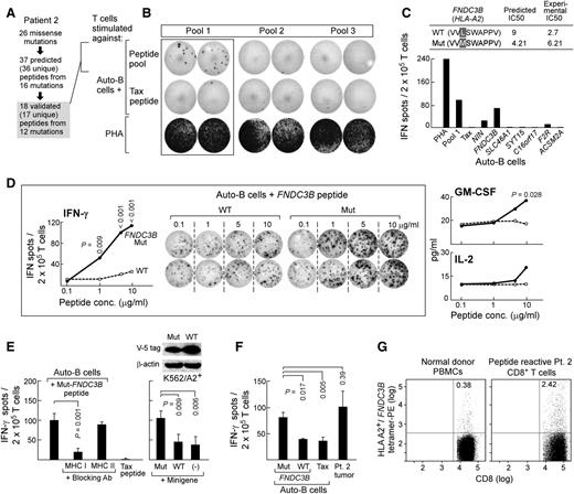 Figure 5. Mutated FNDC3B generates a naturally immunogenic neoepitope in patient 2. (A) Twenty-six missense mutations were identified in patient 2 CLL cells, from which 37 epitopes (from 36 unique peptides; 1 peptide was predicted to bind to 2 HLA alleles) from 16 mutations were predicted to bind to patient 2’s MHC class I alleles. A total of 18 peptides from 12 mutations were experimentally confirmed to bind. Posttransplant T cells (∼4 years) from patient 2 were stimulated with autologous DCs or B cells pulsed with 3 pools of experimentally validated binding mutated peptides (18 peptides total) for 2 weeks ex vivo (supplemental Table 5). (B) Increased IFN-γ secretion was detected by ELISPOT assay in T cells stimulated with pool 1 peptides. (C) Of pool 1 peptides, increased IFN-γ secretion was detected against the mut-FNDC3B peptide (lower, averaged results from duplicate wells are displayed). (Upper) Predicted and experimental IC50 scores of mut- and wt-FNDC3B peptides. (D) T cells reactive to mut-FNDC3B demonstrate specificity to the mutated epitope but not the corresponding wild-type peptide (concentrations: 0.1-10 µg/mL) and are polyfunctional, secreting IFN-γ, GM-CSF, and IL-2 (Tukey post-hoc tests from 2-way analysis of variance modeling; mut vs wt). (E) (Left) Mut-FNDC3B-specific T cells are reactive in a class I-restricted manner and (right) recognize an endogenously processed and presented form of mutated FNDC3B, because they recognized HLA-A2 APCs transfected with a plasmid encoding a minigene of 300 bp encompassing the FNDC3B mutation (2-sided Welch t test) but not wild-type sequences beyond the background of nontransfected APCs alone. (Top right) Western blot analysis confirming expression of minigenes encoding mut- and wt-FNDC3B. (F) Patient 2 CD8+ T cells specifically recognizing mut-FNDC3B (5 μg/mL) demonstrate antitumor responses in an IFN-γ ELISPOT assay (2-sided Welch t test). (G) Specificity of T cells recognizing the mut-FNDC3B epitope detected by HLA-A2+/mut− FNDC3B tetramer-positive T cells in patient 2.