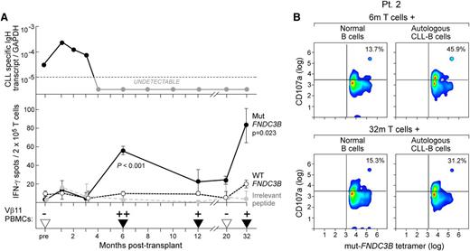Figure 6. Kinetics of the mut-FNDC3B-specific T-cell response in relation to posttransplant course and CD107a degranulation in the presence of tumor cells. (A) (Top) Molecular tumor burden was measured in patient 2 using a patient tumor-specific Taqman PCR assay based on the clonotypic IgH sequence at serial time points before and after HSCT (supplemental Methods). (Middle) Detection of mut-FNDC3B-reactive T cells in comparison with wt-FNDC3B or irrelevant peptides from peripheral blood before and after allo-HSCT by IFN-γ ELISPOT following stimulation with peptide-pulsed autologous B cells. The number of IFN-γ-secreting spots per cells at each time point was measured in triplicate (Welch t test; mut vs wt). (Bottom) Detection of mut-FNDC3B-specific TCR Vβ11 cells by nested clone-specific CDR3 PCR before and after HSCT in peripheral blood of patient 2 (supplemental Methods; supplemental Figure 3). Triangles, time points at which a sample was tested; black, amplification detected, where + indicates detectable amplification up to twofold and ++ indicates more than twofold greater amplification than the median level of all samples with detectable expression of the clone-specific Vβ11 sequence. (B) Evaluation of CD107a expression on 6m/32m mut-FNDC3B-reactive posttransplant CD8+ T cells (effectors) in the presence of patient 2 CLL cells or control donor-engrafted normal B cells in patient 2. The numbers indicate the percentage of mut-FNDC3B tetramer-positive cells that are also CD107a positive. For controls (tetramer negative T cells and nonrelated HLA-A*02:01 tumors), please see supplemental Figures 4 and 5.