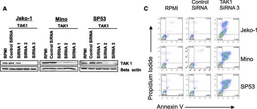 Figure 2. Biological and molecular consequences of silencing TAK1 expression in lymphoma. (A) A representative experiment of TAK1 gene silencing with the use of 3 different siRNAs in lymphoma cell lines. TAK1 protein levels were determined by western blot after 48 hours of transfection. Similar results were obtained in 2 additional independent experiments. (B) TAK-1 gene silencing decreased the phosphorylation of p38 and IКBα without affecting ERK phosphorylation. Results are shown after 48 hours of transfection. (C) TAK1 gene silencing resulted in induction of apoptosis in lymphoma cell lines, as determined by the Annexin V/propidium iodide staining method and FACS analysis. This is a representative experiment performed after 48 hours of transfection with TAK1 siRNA or control siRNA. (D) Summary results of TAK1 siRNA–induced cell death. Each value is the mean of 3 independent experiments performed in triplicate (±SEM). **P < .005. Open bars indicate RPMI, gray bars indicate control siRNA, and black bars indicate TAK1 siRNA3.