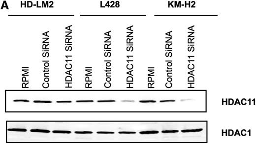 Figure 2. Silencing of HDAC11 gene expression by siRNA upregulates OX40L in HL cell lines. (A) HL cell lines were transfected with HDAC11 or control siRNA (3 μg), and after 48 hours the cellular level of HDAC11 was determined by western blot. Results represent 3 independent experiments showing the efficacy of HDAC11 siRNA in downregulating HDAC11 expression. (B) HL cell lines were analyzed by FACS after 48 hours of HDAC11 siRNA transfection. Blocking HDAC11 increased OX40L expression. (C) Mean fluorescence intensity of 3 independent experiments (±SEM). *P < .05, **P < .005. (D) The Jeko-1 cell line was analyzed by FACS after 24 hours of HDAC11 siRNA transfection. Downregulating HDAC11 did not have any effect on OX40L expression. (E) HDAC11 siRNA induced apoptosis in HL cell lines. (F) Representative experiment demonstrating the effect of downregulating HDAC11 on induction of apoptosis in 3 HL cell lines as determined by propidium iodide and Annexin V staining and FACS analysis. Results are shown after 48 hours of incubation. Each value is the mean of 3 independent experiments (±SEM). *P < .05, **P < .005. (G) Effect of HDAC11 siRNA on the caspase pathway. Downregulation of HDAC11 decreased expression of caspase 9 and caspase 8 in HL cells, as determined after 24 hours of incubation.