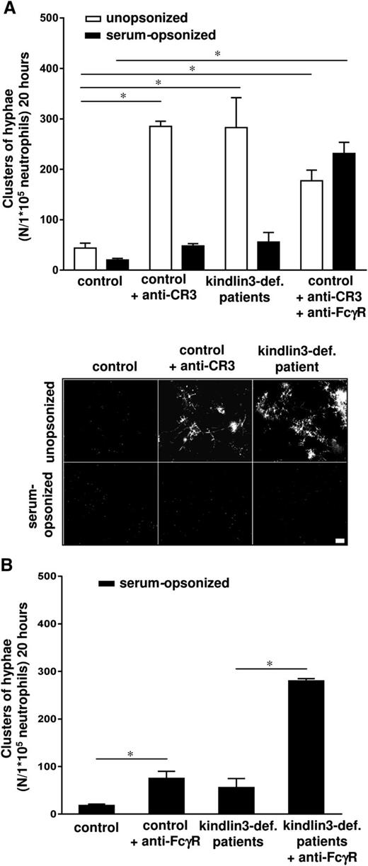 Figure 3. The killing of unopsonized C albicans depends on CR3. (A) Neutrophils from healthy controls, treated with blocking antibodies against CR3 (10 μg/mL IB4 and 44A) and against FcγRs (10 μg/mL) and from kindlin3-deficient patients C and D were cocultured overnight with C albicans–GFP and the clusters of hyphae were assessed microscopically. Scale bar is 50 μm. (B) The inhibition of serum-opsonized C albicans germination by untreated and anti-FcγR (10 μg/mL) treated neutrophils from healthy controls and kindlin3-deficient patients. Results are means ± SEM of at least 3 independent experiments. *P < .05.