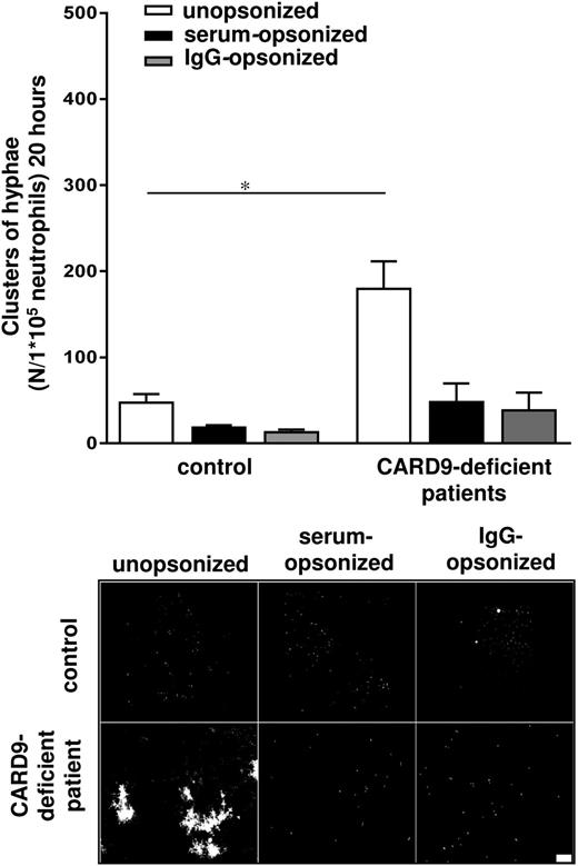 Figure 5. CARD9-deficient neutrophils show a selective C albicans killing defect. Neutrophils from healthy controls and CARD9-deficient patients M and N were cocultured overnight with C albicans–GFP and assessed microscopically. Scale bar is 50 μm. Results are means ± SEM of at least 3 independent experiments. *P < .05.