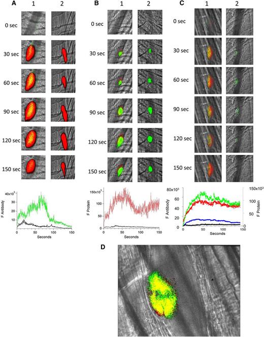 Figure 1. Binding of fluorescently labeled human anti-β2GP1 F(ab′)2, fluorescently labeled β2GP1, or both to the developing thrombus. (A) Binding of fluorescently labeled human anti-β2GP1 F(ab′)2 to the developing thrombus. Anti-β2GP1 F(ab′)2 (2.5 μg/mouse) or control F(ab′)2 (2.5 μg/mouse), each labeled with Alexa 488, and anti-CD42 antibody labeled with Dylight 649 were infused into the mouse 15 minutes before laser-induced arteriolar wall injury. The results shown are for binding of anti-β2GP1 F(ab′)2 derived from sera from APS patient 1. Similar results were obtained with anti-β2GP1 F(ab′)2 derived from sera from APS patient 2. (Top) Representative images of the fluorescence signal associated with anti-β2GP1 F(ab′)2 (green; lane 1) or control F(ab′)2 (green; lane 2) and platelets (red) over 150 seconds after vessel injury are shown within the context of the brightfield histology. Merge (yellow). (Bottom) The median integrated antibody fluorescence (FANTIBODY) associated with thrombus formation after infusion of anti-β2GP1 F(ab′)2 (51 thrombi, 5 mice) or control F(ab′)2 (51 thrombi, 4 mice) over 150 seconds after vessel wall injury. Anti-β2GP1 F(ab′)2 (green); control F(ab′)2 (black). (B) Binding of fluorescently labeled β2GP1 in the presence of human anti-β2GP1 autoantibodies to the developing thrombus. Mice were infused with β2GP1 (25 μg/mouse) or HSA (25 μg/mouse), each labeled with Alexa 647, anti-β2GP1 autoantibodies (10 μg/mouse), and anti-CD42 antibody labeled with Dylight 488 before laser-induced arteriolar wall injury. (Top) Representative images of the fluorescence signal associated with β2GP1 (lane 1, red) or HSA (lane 2, red) and anti-CD42 antibody labeled with Dylight 488 for platelet detection (green) over 150 seconds after vessel injury are shown within the context of the brightfield histology. Merge (yellow). (Bottom) Median integrated protein fluorescence (Fβ2GP1 or FHSA) associated with thrombus formation in 3 wild-type mice after infusion of β2GP1 conjugated to Alexa 647 (27 thrombi, 3 mice) or HSA control conjugated to Alexa 647 (24 thrombi, 3 mice) over 150 seconds after vessel wall injury. β2GP1 (red); HSA (black). (C) Simultaneous binding of fluorescently labeled anti-β2GP1 autoantibodies and fluorescently labeled β2GP1 during thrombus formation after laser-induced injury. Mice were infused with labeled anti-β2GP1 F(ab′)2 (2.5 μg) derived from patient 2 plus labeled β2GP1 (25 μg) or labeled control F(ab′)2 (2.5 μg) plus labeled HSA (25 μg) 15 minutes before laser-induced arteriolar wall injury. (Top) Representative images of the fluorescence signal associated with Alexa 488-labeled anti-β2GP1 F(ab′)2 (lane 1, green) or Alexa 488–labeled control F(ab′)2 (lane 2, green) and Alexa 647–labeled β2GP1 (lane 1, red) or Alexa 647–labeled HSA (lane 2, red) over 150 seconds after vessel injury are shown within the context of the brightfield histology. Merge (yellow). (Bottom) The median integrated fluorescence, (FANTIBODY) and (FPROTEIN), of antibody and protein, respectively, associated with thrombus formation after infusion of Alexa 488–labeled anti-β2GP1 F(ab′)2 and Alexa 647–labeled β2GP1 (25 thrombi, 3 mice) or Alexa 488–labeled control F(ab′)2 and Alexa 647–labeled HSA (26 thrombi, 2 mice) over 150 seconds after vessel wall injury. Anti-β2GP1 F(ab′)2 (green); control F(ab′)2 (blue); β2GP1 (red); HSA (black). (D) High-resolution confocal intravital imaging of binding of the anti-β2GP1 autoantibody/β2GP1 complex during thrombus formation after laser-induced injury. Confocal image of thrombus formation 60 seconds after vessel wall injury. Alexa 488–labeled anti-β2GP1 F(ab′)2 (green); β2GP1 (red); merge (yellow). A single confocal slice through the center of the thrombus is shown.