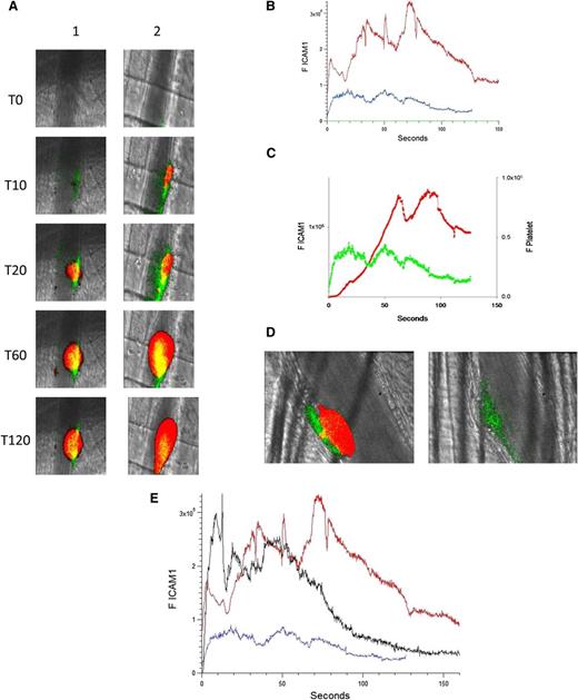 Figure 3. Endothelial cell activation is enhanced at the site of vascular injury in the presence of anti-β2GP1 autoantibodies in vivo. (A) Representative images of ICAM-1 and platelets in the developing thrombus from time 0 to 120 seconds obtained before (left panel, lane 1) and 15 minutes after (right panel, lane 2) infusion of 10 μg of human anti-β2GP1 autoantibodies. ICAM-1, green; platelets, red; merge, yellow. (B) The median integrated ICAM-1 fluorescence (F ICAM-1) associated with thrombus formation before (19 thrombi, 4 mice; blue) and 15 minutes after (27 thrombi, 4 mice; red) infusion of 10 μg of anti-β2GP1 IgG over 150 seconds after vessel wall injury. An irrelevant IgG in place of the anti-ICAM-1 antibody is shown (21 thrombin, 2 mice; green). (C) Comparison of the kinetics of ICAM-1 expression (green) and platelet accumulation (red) during thrombus formation in the absence of anti-β2GP1 IgG. (D) Confocal imaging of ICAM-1 after vascular injury indicates ICAM-1 is localized on the endothelium and not the platelet thrombus. Confocal images of ICAM-1 and platelets were obtained 60 seconds after laser injury during thrombus formation. (Left) ICAM-1 was visualized using anti-ICAM-1 labeled with Alexa 488 (0.4 μg/g mouse) (green) and platelets were visualized using anti-CD42 antibody labeled with Dylight 649 (0.1 μg/g mouse) (red). Merge, yellow. (Right) In the presence of eptifibatide (10 μg/g mouse) and its elimination of platelets, ICAM-1 was visualized on the endothelial surface. Confocal images were obtained through a central section of the thrombus. These confocal images are obtained at high speed in a live mouse where there is minor vessel movement with during each systole. Furthermore, the green and the red images are obtained near simultaneously but not simultaneously. Therefore, the register of the composite image is not perfect. Finally, there is low background noise that we elected not to subtract. We quantitated the fluorescence corresponding to total ICAM-1 fluorescence in the image and quantitated the fluorescence corresponding to the ICAM-1 fluorescence within the thrombus, as defined by platelet fluorescence. (E) F(ab′)2 fragments of anti-β2GP1 autoantibodies enhance activation of endothelial cells similarly to intact anti-β2GP1 autoantibodies. Endothelial cell activation was monitored using anti-ICAM-1 conjugated to Alexa 488 (0.5 μg/g) and platelets were monitored using anti-CD42 antibody conjugated with Dylight 649 (0.1 μg/g) before and 20 minutes after infusion of 12 μg of F(ab′)2 fragments of anti-β2GP1. ICAM-1 expression in endothelial cells was observed in an arteriole before (blue; 19 thrombi, 4 mice) and 20 minutes after infusion of 12 μg of F(ab′)2 fragments of anti-β2GP1 (black; 14 thrombi, 2 mice) or 10 μg of intact anti-β2GP1 (red; 27 thrombi, 4 mice).
