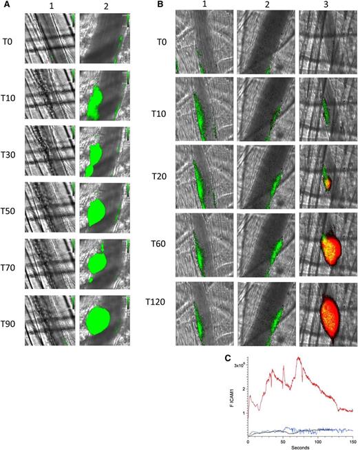 Figure 4. Platelet thrombus is required for enhanced endothelial cell activation in the presence of anti-β2GP1 autoantibodies. (A) Infusion of eptifibatide (10 μg/g mouse) initially inhibits platelet interaction with the injured vessel wall but its effect is gone by 60 minutes. Platelets were labeled using anti-CD42 antibody conjugated to Dylight 488 (0.1 μg/g) and platelet fluorescence (green) imaged at 488 nm. Images were obtained with the high-resolution CMOS camera that resolves individual platelets. (Lane 1) Image at time 0. (Lane 2) Image at time 60 minutes after eptifibatide infusion. (B) Representative images of ICAM-1 and platelets in the developing thrombus from time 0 to 120 seconds obtained in the presence of eptifibatide (10 μg/g mouse) (lane 1); human anti-β2GP1 autoantibodies (10 μg) and eptifibatide (10 μg/g mouse) (lane 2); human anti-β2GP1 autoantibodies (10 μg) in the absence of eptifibatide (lane 3). ICAM-1, green; platelets, red. (C) The median integrated ICAM-1 fluorescence (F ICAM-1) associated with thrombus formation in wild-type mice infused with human anti-β2GP1 autoantibodies (27 thrombi, 4 mice; red); human anti-β2GP1 autoantibodies and eptifibatide (27 thrombi, 3 mice; blue); and eptifibatide (18 thrombi, 3 mice; black).