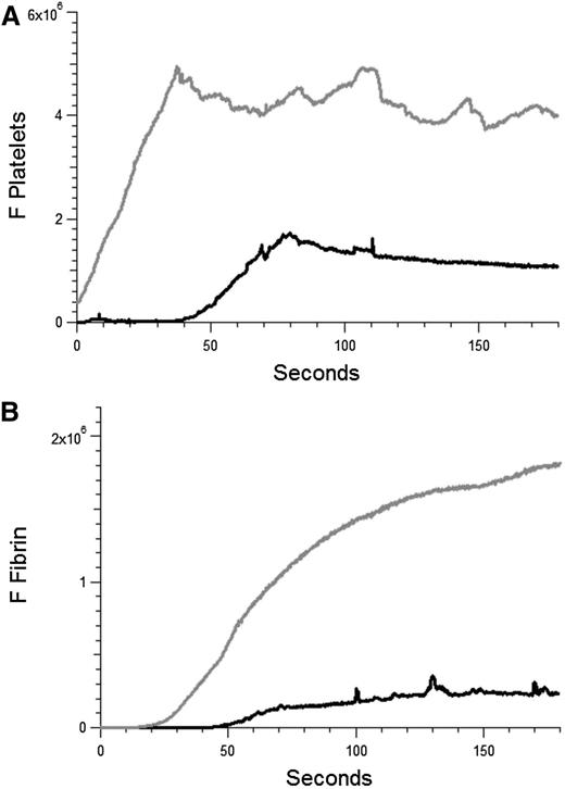 Figure 7. Anti-β2GP1 autoantibodies amplify thrombus formation in venules. Effect of purified anti-β2GP1 autoantibodies on thrombus size and fibrin generation in venules. Anti-β2GP1 autoantibodies were infused into wild-type mice 5 minutes before laser-induced venule wall injury. Platelet and fibrin imaging was performed using anti-CD42 antibody labeled with Dylight 649 (0.1 μg/g mouse) and anti-fibrin antibody labeled with Alexa 488 (0.5 μg/g mouse). Platelet thrombus size and fibrin generation at the site of laser-induced injury were determined by calculating median fluorescence values at 649 nm and 488 nm over 3 minutes, respectively. After initial laser injury of the venule wall, a thrombus composed of platelets (A) and fibrin (B) was generated; 15 minutes after infusion of 10 μg of anti-β2GP1 autoantibodies, anti-β2GP1 autoantibody–induced changes in platelet thrombus size and fibrin generation were observed. The kinetics of the fluorescence signals associated with platelets and fibrin over 180 seconds after vessel injury are shown before (black) and after (gray) infusion of anti-β2GP1 autoantibodies.