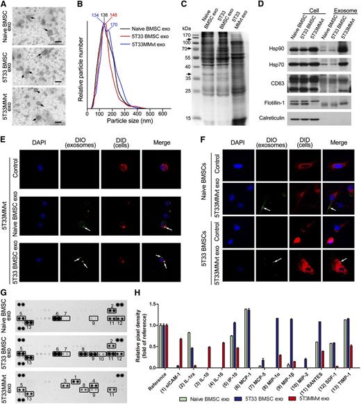 Figure 1. Exosome mediate communication between BMSCs and MM cells. (A) Transmission electron microscopy images of exosomes derived from BMSCs and 5T33MMvt cells. The scale bars indicate 100 nm, and the arrows indicate the typical exosomes. (B) Size distributions of BMSC- and MM cell-derived exosomes were identified using the NTA. (C) Coomassie blue-stained sodium dodecyl sulfate-polyacrylamide gel electrophoresis gel after separation of total lysates from naive BMSC, 5T33 BMSC-derived, and 5T33MMvt cell-derived exosomes. Arrows indicate different protein bands between naive and 5T33 BMSC-derived exosomes. (D) Exosomal positive markers Hsp90, Hsp70, CD63, and flotillin-1 were detected in naive, 5T33 BMSC-derived, and 5T33MMvt cell-derived exosomes using western blot, whereas negative marker calreticulin was not. (E) DID-labeled 5T33MMvt cells (red) were incubated with DIO-labeled naive or 5T33 BMSC-derived exosomes (100 μg/mL, green) for 2 hours, and the exosome uptake by MM cells was detected (original magnification, ×740). Arrows indicate the fusion of the membrane. (F) DID-labeled naive or 5T33 BMSCs (red) were incubated with DIO-labeled 5T33MMvt exosomes (100 μg/mL, green) for 2 hours, and the exosome uptake by BMSCs was detected (original magnification, ×740). Arrows indicate the fusions of the membrane. (G) Cytokines in BMSC-derived and 5T33MMvt cell-derived exosomes were analyzed using a mouse cytokine array. (H) The pixel densities of proteins in cytokine array were quantified and presented as the fold of reference.