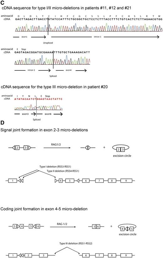 Figure 2. Breakpoints of PTEN microdeletions. (A) Schematic representation of the PTEN gene. Missense mutations are represented by open triangles above the exons, whereas a silent mutation is presented as a filled gray triangle as shown before.18 Nonsense insertion/deletion mutations are indicated by a filled black triangle. Left- or right-pointing open triangles in introns 1, 3, and 5 represent cRSSs. (B) Sequences of cloned intron 1-3 type I and type II breakpoints and the intron 3-5 type III breakpoint for T-ALL patients with PTEN microdeletions. cRSSs are indicated by a box with the canonic CAC trinucleotide sequences or the corresponding GTG nucleotides in heptamer sequences indicated in bold and underlined. Insertion of non-template, random nucleotides are shown in bold. (C) Examples of sequence traces of cDNA resulting from type I, II, and III microdeletions. (D) Involvement of specific cRSSs in illegitimate RAG-mediated recombination events resulting in types I and II microdeletions (signal joint) and aberrant PTEN splice variant or the type III with the aberrant exon 4-5 microdeletion PTEN transcript (coding joint).