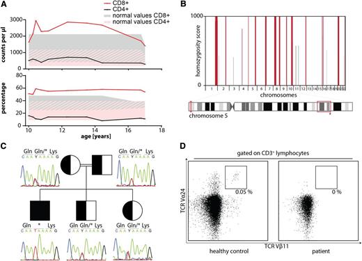 Figure 1. Immunological and genetic analysis. (A) The patient presented with persistently low numbers of CD4+ T-cells and elevated numbers of CD8+ T-cells throughout a period of 7 years. (B) Homozygosity mapping identified several homozygous regions. ITK (asterisk) was located inside a homozygous region on chromosome 5. (C) Identification of a homozygous nonsense mutation (c.C49T:p.Q17X) in the gene ITK. (D) The index patient shows complete absence of TCRVα24+/TCRVβ11+ iNKT-cells.