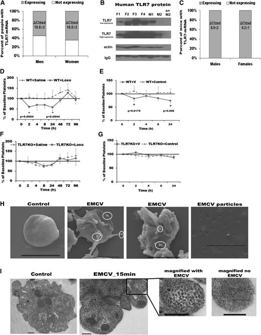 Figure 1. TLR7 is present in human and mouse platelets and TLR7 activation induces a reduction in platelet count. (A) TLR7 mRNA levels in human platelets from participants in the FHS (n = 1889, 839 men and 1050 women) screened by qPCR. (B) TLR7 protein levels in human platelets of 6 healthy donors (not involved in the FHS) screened by western-blot analysis (F, females; M, men). (C) TLR7 mRNA levels in murine platelets screened by qPCR (n = 5 males, n = 6 females). (D-G) WT (baseline platelet count 729 ± 167 × 103 platelets/μL) and TLR7KO male mice (baseline platelet count 780 ± 147 × 103 platelets/μL) at 14 weeks of age were injected (once) with TLR7 agonist, Loxo or at 17 weeks of age with EMCV. Percent of baseline platelet count in WT (D) and TLR7KO (E) mice injected with Loxo and WT (F) and TLR7KO (G) mice infected with EMCV. SEMs (H) and TEMs (I) of human platelets treated with EMCV. White circles in H encompass viral particles. Bar represents 2 μm in H and 0.2 μm in I. Data are average ± SD and were analyzed by Student t test using n = 5 animals/group (C-H).