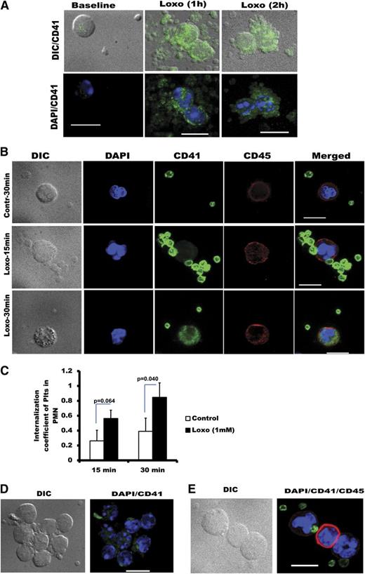 Figure 5. Rapid thrombocytopenia induced by TLR7 stimulation is caused by granulocyte (neutrophil) internalization of platelets and continued leukocyte aggregate formation. (A) Confocal microscopy of murine blood postinjection with Loxo. Mice were transfused with CFSE-labeled platelets; blood was drawn, fixed, and stained with 4,6 diamidino-2-phenylindole (DAPI). (B) Confocal microscopy of human blood prestained with CD41-FITC and CD45-CY5 (CD41-green stains are platelets and CD45-red stains are leukocytes) and stimulated with Loxo. DAPI (blue) stains the nucleus and was added postfixation. Cells are identified as neutrophils according to their lobularity and intensity of CD45. (C) Internalization coefficient measured by IDEAS-software (Amnis FlowSight Cytometry) in human blood. In these studies, CD45 was used to define the outside of the neutrophils, and CD41 is the internalization probe (n = 4). (D-E) Confocal images of human or murine blood showing large aggregates of platelets and WBCs. (D) Murine blood of mice transfused with CFSE-labeled platelets and injected with Loxo, fixed, and stained with DAPI. (E) Human blood treated ex vivo with Loxo (15 minutes) and stained with CD41 (green)-platelets, CD45 (red)-leukocytes, or DAPI (blue)-nucleus. In all cases, pictures are representative of: n = 3 (A), n = 5 (B); n = 4 (C), n = 3 (D), and n = 5 (E). Data in C are average ± SD and were analyzed by Student t test. Images in A-B and D-E were taken with spinning disk confocal microscope and Metamorph 7.4.2 software and merged by ImageJ (NIH) software. Pictures were taken with ×100 Plan Apo oil lens and the scale bar is 10 μm.