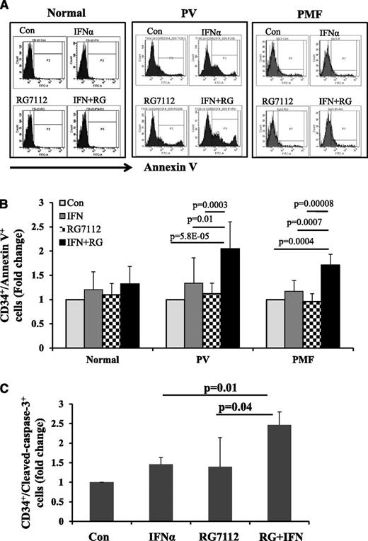 Figure 2. Low doses of RG7112 and Peg-IFNα 2a in combination promote MPN CD34+ cell apoptosis. (A) Flow cytometric analysis showing the results of Annexin V staining on normal, PV, and PMF CD34+ cells after 2 days of treatment with 200 nM of RG7112 or 200 ng/mL of Peg-IFNα 2a alone or in combination. (B) Histogram showing the effects of these treatments on the CD34+/AnnexinV+ cell population in normal (n = 5), PV (n = 8), and PMF (n = 6) CD34+ cells after 2 days of treatment with 200 nM of RG7112 or 200 ng/mL of Peg-IFNα 2a alone or in combination. (C) Histogram showing the effects of 4 days of drug treatment on PV CD34+/cleaved caspase-3+ cells (n = 6, P < .05).