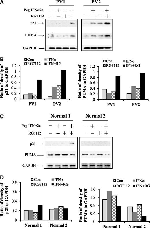 Figure 4. Western blot results show that low doses of RG7112 and Peg-IFNα 2a increase p21 and PUMA protein levels in PV CD34+ cells. (A) Western blotting shows p21 and PUMA protein levels in 2 individual PV samples after treatment with low doses of RG7112 or Peg-IFNα 2a alone or in combination. (B) The ratio of the degree of p21/GAPDH in PV samples. (C) Western blotting of p21 and PUMA protein levels in 2 individual normal samples after treatment with low doses of RG7112 or Peg-IFNα 2a alone or in combination. (D) The ratio of the degree of p21/GAPDH in normal samples.