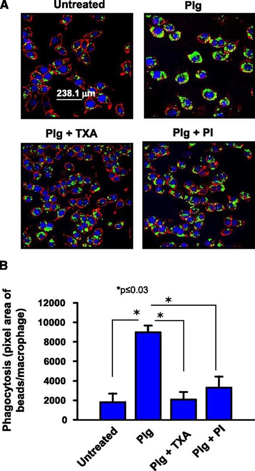 Figure 2. Plg promotes phagocytosis of IgG-coated microbeads by J774A.1 cells. J774A.1 macrophage-like cells were pretreated with or without Plg (1 μM) for 24 hours in the presence or absence of TXA (200 μM) or PI (20 nM). (A) Confocal microscopic images of macrophages with ingested IgG-opsonized green latex beads. Images at original magnification of ×63 were captured as in Figure 1. The plasma membrane is stained with anti-CD45 (red). The cells are counterstained with 4′,6 diamidino-2-phenylindole (blue). (B) Quantification (means ± SD) of IOD of ingested beads per macrophage. Results are representative of 3 independent experiments.