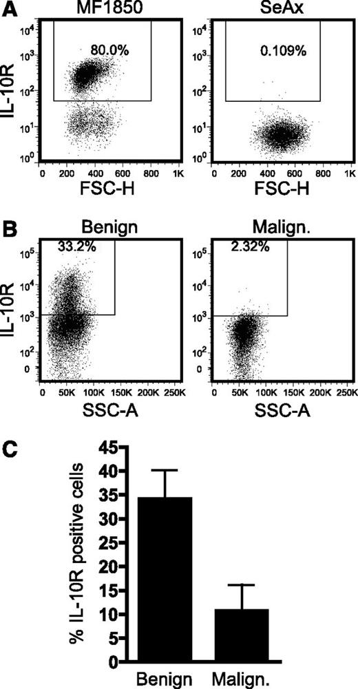 Figure 6. IL-10R expression is low or absent on the malignant T cells. (A) Representative flow cytometric analysis of IL-10 receptor (IL-10R) expression on the benign T-cell line, MF1850, and the malignant T-cell line, SeAx. (B) Representative flow cytometric analysis of IL-10R expression on benign (CD4+CD26+) and malignant (CD4+CD26−) T cells in PBMCs from an SS patient. (C) Graph showing the average percentage of IL-10R–positive benign (CD4+CD26+) and malignant (CD4+CD26−) T cells in PBMCs isolated from 5 SS patients. Bars represent SEM. FSC-H, forward scatter height; SSC-A, side scatter area.