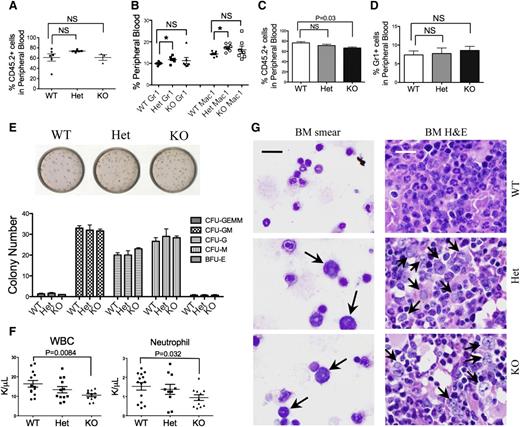 Figure 2. Mice with mDia1 deficiency developed age-related MDSs. (A) Transplantation of total bone marrow cells from indicated mice (CD45.2+) to lethally irradiated mice (CD45.1+). Flow cytometric analysis of CD45.2+ cells in the peripheral blood was performed 1 month after transplantation. WT: N = 6, Het: N = 5, KO: N = 3. (B) Same as in panel A except that Gr1/Mac1 double-positive cells were analyzed. N = 7 in each group. (C) Transplantation of LSK cells (CD45.2+) from indicated mice to lethally irradiated recipient mice (CD45.1+). The percentage of peripheral blood CD45.2+ cells was determined 1 month after transplantation. N = 3 in each group. (D) Same as in panel C except that Gr1+ cells were analyzed by flow cytometry. (E) Colony-forming unit (CFU) assay of various hematopoietic lineages derived from LSK cells of indicated mice (6-8 weeks of age). BFU-E, burst-forming unit, erythrocytes; G, granulocytes; GEMM, granulocytes, erythrocytes, monocytes/macrophages; GM, granulocytes, monocytes; M, monocytes. Data were representative of at least 3 independent experiments. (F) White blood cell and neutrophil counts of mice 1 month after transplantation with mDia1 wild-type, heterozygous, and knockout total bone marrow cells. (G) Wright-Giemsa stains of bone marrow smears (left panels) and hematoxylin and eosin (H&E) stains of bone marrow sections (right panels) of indicated mice (>1.5 years). Arrows indicate dysplastic granulocytes. Scale bars represent 30 μm. The stains were representatives of 3 animals from each genotype.