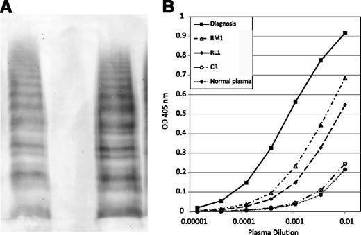 Figure 1. VWF multimer patterns and anti-VWF IgG titers. (A) Multimer analysis. Lane 1, normal control; lane 2, patient plasma at diagnosis; lane 3, patient plasma at RM1. All specimens were run on the same gel. (B) IgG anti-VWF antibody titer. All specimens were assayed in the same run for comparison.
