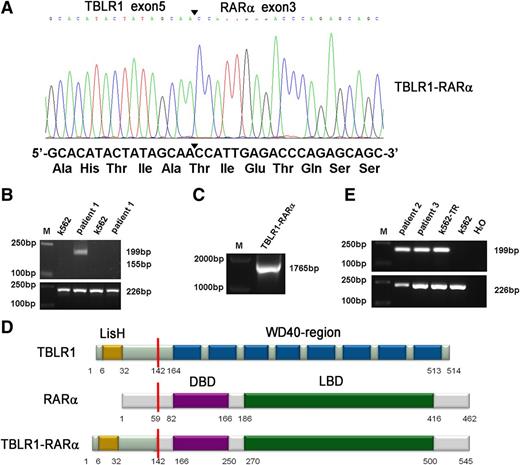 Figure 2. Molecular analysis and identification of the TBLR1-RARα fusion transcript. (A) Partial sequence analysis of the TBLR1-RARα transcript. TBLR1 exon 5 was fused to exon 3 of RARα. The junction site of TBLR1 and RARα is highlighted by a bold arrowhead. The TBLR1-RARα encodes an in-frame fusion transcript; its partial DNA sequence and the corresponding translated amino acid sequence are shown. (B) RT-PCR analysis of TBLR1-RARα fusion transcript and reciprocal RARα-TBLR1 fusion transcript. TBLR1-RARα fusion transcript (lane 3) was amplified from cDNA derived from the patient 1’s BMMNCs at diagnosis with an internal control (GAPDH) by RT-PCR, whereas the reciprocal RARα-TBLR1 fusion transcript (lane 5) was not detected. cDNA derived from K562 was used as a negative control. (C) Amplification of full-length TBLR1-RARα by RT-PCR. Full-length TBLR1-RARα was also detected from patient 1’s BM samples. (D) Schematic representation of TBLR1, RARα, and TBLR1-RARα proteins. TBLR1-RARα fusion protein contains 545 amino acids (aa), including a LisH domain (6-32 aa) in the TBLR1 portion and a DNA-binding domain (DBD; 166-250 aa) and a ligand-binding domain (LBD; 270-500 aa) in the RARα portion. The break point is indicated by the red line. (E) RT-PCR analysis of TBLR1-RARα fusion transcripts in the other 2 APL patients harboring t(3;17) chromosomal translocation. TBLR1-RARα fusion transcripts (lanes 2 and 3) were amplified from cDNAs derived from the APL patients’ BMMNCs at diagnosis with an internal control (GAPDH) by RT-PCR. cDNA derived from K562 was used as a negative control, and cDNA derived from K562 transfected with TBLR1-RARα (K562-TR) was used as a positive control.