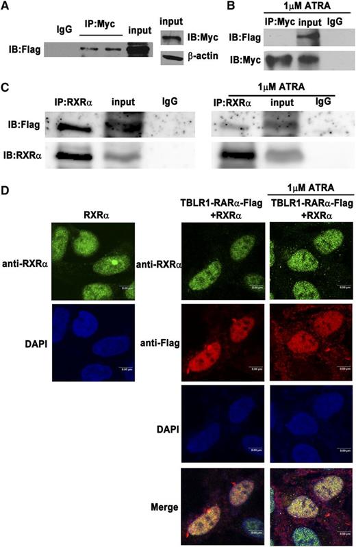 Figure 3. Identification of homodimerization and heterodimerization of TBLR1-RARα fusion proteins by Co-IP. The 293T cells were transfected with both Myc- and Flag-tagged TBLR1-RARα expression plasmids. (A) Homodimerization of TBLR1-RARα was detected in 293T cells by Co-IP. β-actin was used as an internal control. (B) Homodimerization could not be detected in 293T cells after treatment with 1 μM ATRA for 48 hours by Co-IP. (C) RXRα and Flag-tagged TBLR1-RARα expression plasmids were transfected into 293T cells with or without 1 μM ATRA treatment of 48 hours. Flag-tagged TBLR1-RARα could coimmunoprecipitate with RXRα (left). Heterodimers could still be detected in the presence of ATRA treatment (right). (D) Immunofluorescence analysis of 293T cells transfected with RXRα expression plasmid alone (left) or together with Flag-tagged TBLR1-RARα plasmid (right). The latter was incubated with or without 1 μM ATRA for 48 hours. Flag and RXRα antibodies were used as primary antibodies, and DAPI was used for nuclear staining. At least 100 cells were counted for colocalization analysis. Bars represent 8 μm. IB, immunoblotting; IgG, control IP with isotype antibody; Input, nonimmunoprecipitated cell lysates; IP, immunoprecipitation.