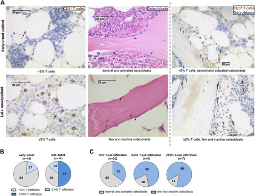 Figure 4. Patients with late onset of B-cell reconstitution display increased numbers of BM-infiltrating T cells associated with reduced numbers of osteoblasts. (A) Histological sections of BM trephines obtained 3 to 4 weeks after allo-HSCT were analyzed for the number of CD3+ T cells and osteoblasts. Graphs show representative examples for the staining of formalin-fixed sections from patients with (upper) early or (lower) late onset of B-cell reconstitution. CD3 immunostaining (brown) is shown in the left graphs and evaluation of osteoblast number and morphology on hematoxylin and eosin-stained sections is shown in the center graphs (arrows indicate osteoblasts). In the right graphs, osteoblasts are indicated with arrows on CD3 antibody-stained (brown) sections. T cells are marked with triangles. (B) The percentage of patients displaying <5% (gray), 5% to 9% (light blue), and ≥10% (dark blue) T-cell infiltration in the analyzed BM compartment is shown for patients within the (left) early and (right) late onset group. (C) The percentages of patients with only few and inactive (blue) and of patients with several and activated (gray) osteoblasts within the patient groups displaying (left) <5%, (center) 5% to 9%, or (right) ≥10% T-cell infiltration are depicted. Numbers in the pie charts indicate the percentage of patients within the respective group.