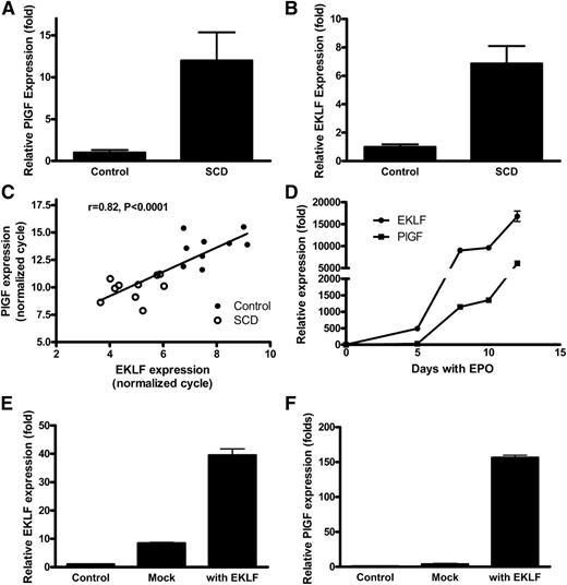 Figure 3. PlGF and EKLF are expressed simultaneously at high levels in vivo in patients with SCD and expression of PlGF follows EKLF expression in isolated erythroid cells. (A) PlGF and (B) EKLF expression is significantly higher among SCD patients than healthy controls, and (C) expression of PlGF and EKLF is correlated with each other, indicating that PlGF may be the target of EKLF. (D) Erythroid progenitor cells were cultured by a 2-phase approach and treated with EPO, cells were harvested, and quantitative PCR performed to detect the expression of EKLF and PlGF. The results show that EKLF and PlGF are expressed during erythroid development, with EKLF expression preceding that of PlGF. (E-F) EKLF and PlGF expression in isolated human erythroid progenitor cells. Erythroid progenitor cells were cultured, and then EKLF was transfected by electroporation. Cells were harvested on day 5. Overexpression of EKLF leads to increased PlGF expression in erythroid progenitor cells.