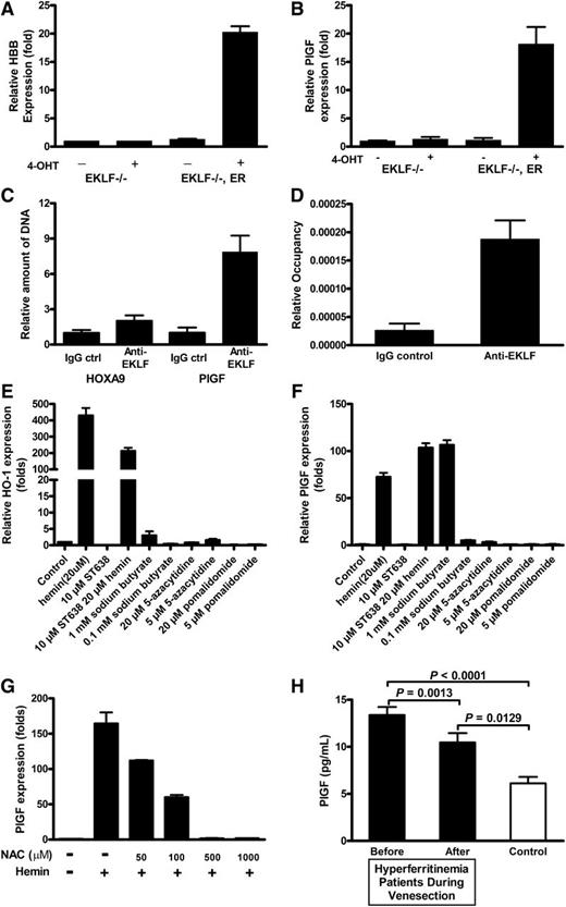 Figure 4. EKLF is required for PlGF expression, and iron overload is significantly related to mortality. Enforced EKLF expression in EKLF knockout erythroid cells increases (A) hemoglobin and (B) PlGF expression, whereas EKLF knockout erythroid cells are not able to respond in the same manner, suggesting that EKLF is required for PlGF induction. (C-D) Quantitative PCR results from anti-EKLF ChIP. EK-1 cells were treated as described in “Materials and methods.” Immunoprecipitation was carried out with anti-EKLF. After immunoprecipitation, quantitative PCR was performed to determine the amount of DNA precipitated. (E) HO-1 and (F) PlGF expression in K562 with indicated chemicals. ST638 was incubated with K562 for 30 minutes before hemin was included. (G) Hemin-induced PlGF expression was attenuated by NAC treatment. K562 cells were treated with indicated concentrations of NAC 30 minutes before hemin induction. Cells were harvested after 24 hours, RNA was extracted, and quantitative PCR was performed on cDNA preparations. (H) Patients with HH the most common form of iron overload disease, at the time of initial diagnosis have elevated levels of serum ferritin and PlGF (r = 0.241, P = .06, Spearman correlation). When ferritin levels are lowered by phlebotomy therapy, the PlGF concentration significantly decreases (P = .0013).