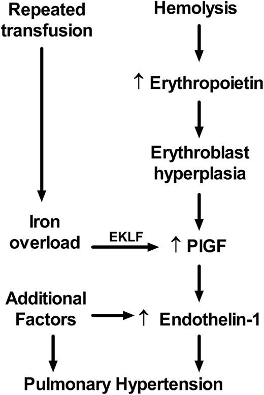 Figure 5. Proposed model of the iron overload/EKLF/PlGF/ ET-1 pathway. Erythroblast expression of PlGF is affected by erythroblast hyperplasia induced by erythropoietin as a compensatory response to hemolytic anemia. PlGF expression is augmented in some patients by excess iron via EKLF as a consequence of repeated therapeutic transfusion of red blood cells. PlGF induces expression of endothelin-1, which promotes pulmonary artery vasoconstriction and eventual pulmonary hypertension. Additional factors are also involved in dysregulation of endothelin-1 expression, such as expression of inflammatory cytokines, and several more pathways contribute to the development of pulmonary hypertension.