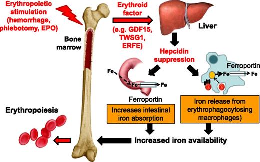 Figure 1. Hepcidin regulation by erythropoiesis and its effects on iron efflux from cells involved in iron metabolism. Hepcidin plays a central role in the maintenance of iron homeostasis and regulation of plasma iron concentrations by controlling ferroportin concentrations on iron-exporting cells, including duodenal enterocytes, recycling macrophages of the spleen and liver, and hepatocytes (involved in iron storage). The bone marrow has the highest iron requirements for hemoglobin synthesis, and thus, increased erythropoietic activity suppresses hepcidin production. Several potential candidate erythroid regulators of hepcidin (eg, GDF15 and TWSG1) in β-thalassemia have been reported. Recently, a non–disease-specific mechanism has been proposed (eg, ERFE). EPO, erythropoietin; Fe, iron; TWSG1, twisted gastrulation 1.