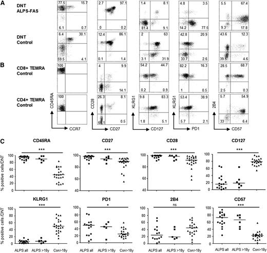 Figure 2. ALPS DNT have a distinct differentiation pattern. Representative plots showing ex vivo expression of the indicated differentiation markers on (A) ALPS and control DNT (gate: CD3+TCRαβ+CD4−CD8−), and (B) on control CD8+TEMRA and CD4+TEMRA cells (gate: CD3+CD8+CCR7−CD45RA+ or CD3+CD4+CCR7−CD45RA+) (C) Expression of differentiation markers on DNT of all studied ALPS patients (ALPS all), adult ALPS patients (ALPS >18 y), and adult controls (Con >18 y); statistical comparison was performed between all ALPS patients and adult controls. ns, not significant. *P < .05; ***P < .001.