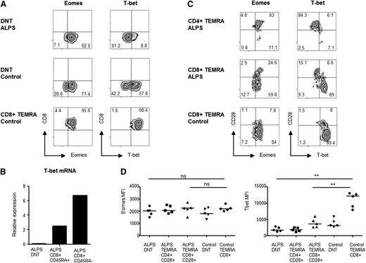 Figure 5. ALPS DNT lack T-bet expression. (A) Representative plots showing expression of Eomes and T-bet in ALPS and control DNT (gate: CD3+TCRαβ+CD4−CD8−), and in control CD8+TEMRA cells (gate: CD3+CD8+CCR7−CD45RO−). (B) T-bet messenger RNA was quantified by RT-PCR using sorted DNT, CD8+CD45RA+, and CD8+CD45RA− T-cell populations. CD8+CD45RA− memory cells served as a positive control because the proportions of TEMRA cells were too low. Representative data from 1 of 4 analyzed ALPS-FAS patients are shown. (C) CD4+TEMRA, CD8++TEMRA, and DNT were gated and analyzed for Eomes and T-bet expression in combination with CD28 to distinguish between “DNT-like” (CD28+) and “normal” (CD28−) TEMRA cells. (D) T-bet and Eomes levels were compared between ALPS DNT, control DNT, CD4+CD28+TEMRA, and CD8+CD28+TEMRA from 5 ALPS patients and CD8+TEMRA from 5 healthy donors. The great majority of control CD8+TEMRA were CD28−. MFI, mean fluorescence intensity; ns, not significant. **P < .01.