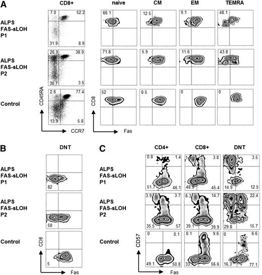 Figure 7. Double mutated T cells accumulate among CD4 and CD8 TEMRA cells in patients with ALPS-FAS-sLOH. (A) Fas expression is shown on naïve (naïve, CCR7+CD45RA+), central memory (CM, CCR7+CD45RA−), effector memory (EM, CCR7−CD45RA−), and terminally differentiated CD8+ T cells (TEMRA, CCR7−CD45RA+), and (B) on CD3+TCRαβ+CD4−CD8− DNT of 2 patients with ALPS-FAS-sLOH (P1: 14 y, P2: 32 y) compared with an adult control. (C) CD57 and Fas expression on CD4+, CD8+, and DNT of the same patients compared with an adult control.