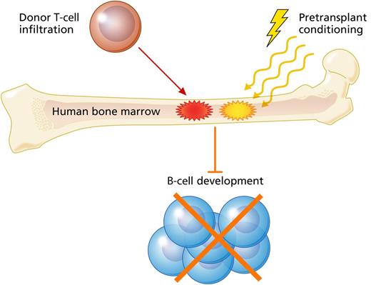 Mensen et al present data indicating that GVHD, donor T-cell infiltration in recipient marrow, and high intensity pretransplant conditioning were associated with impaired B-cell reconstitution in adult patients who underwent allogeneic hematopoietic transplantation for treatment of acute leukemia. Professional illustration by Patrick Lane, ScEYEnce Studios.