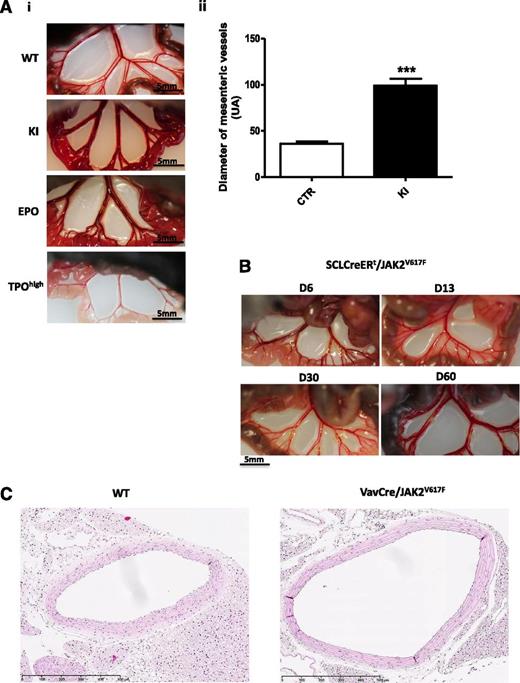 Figure 6. Vasodilation in JAK2V617F mice. (Ai) Representative images of the macroscopic aspect of mesenteric vessels from VavCre/JAK2V617F (KI), EPO-treated, and TPOhigh mice. Bars represent 5 mm. (Aii) Diameters of mesenteric VavCre/JAK2V617F vessels (KI) and matched controls (CTR) (n = 12). ***P < .0001. (B) Representative images showing that the increase in diameter of mesenteric vessel of SCLCreERt/JAK2V617F mice appeared 60 days (D60) after treatment by tamoxifen. (C) Representative transverse sections (n = 3) of the aorta from 1 WT and 1 VavCre/JAK2V617F (hematoxylin and eosin staining). Bars represent 500 µm.
