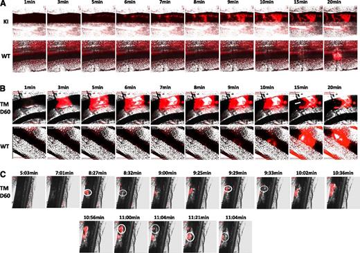 Figure 7. In vivo thrombosis. Representative images of n = 3 (for each mouse) of in vivo thrombosis experiments. FeCl3 injury of mesenteric vessels was performed in VavCre/JAK2V617F mice (A) or SCLCreERt/ JAK2V617F mice 2 months after treatment by tamoxifen (B and C). The accumulation of rhodamin 6G-stained platelets (in red) was recorded. The white arrow in panel B indicates signs of accelerated thrombus lysis, and the white circles in panel C indicate thrombus embolization. Note that the time to occlusion in JAK2V617F KI mice is reduced as compared with their controls. Original magnification ×5 for all panels.
