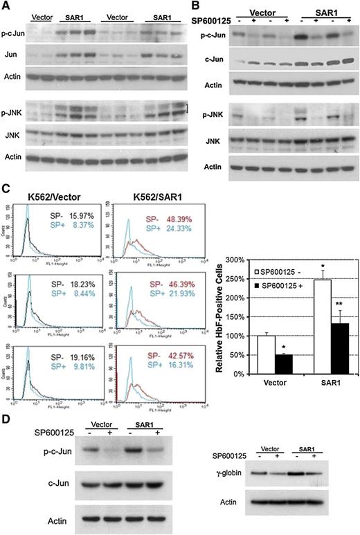 Figure 5. SAR1 enhances HbF expression through the activation of JNK/Jun signaling. (A) Western blot analysis of SAR1- or vector control–stably transfected K562 cells for expression of phospho- and total c-Jun and phospho- and total JNK. (B) Western blot analysis of SAR1- or vector control–stably transfected K562 cells for expression of phospho- and total c-Jun and phospho- and total JNK after incubation in the absence or presence of the JNK phosphorylation inhibitor SP600125 (12.5 μM) for 5 days. β-actin was used as a loading control. (C) SAR1- or vector control–stably transfected K562 cells incubated in the absence or presence of SP600125 (12.5 μM) for 5 days were stained with PE-conjugated anti-HbF antibody and subjected to flow cytometry for measurement of HbF-positive cells. Left panels, representative flow cytometry results. Right panel, Graphical representation of flow cytometry data for HbF protein expression in SAR1- or vector control–stably transfected K562 cells with or without SP600125 treatment. *P < .001 vs vector control–transfected cells without SP600125 treatment, **P < .001 vs SAR1-transfected cells without SP600125 treatment. Error bars represent SD of the mean of >3 independent experiments. (D) Western blot analysis of SAR1- or vector control–transfected CD34+ cells for expression of phospho- and total c-Jun (left panel) and γ-globin chain (right panel) after incubation in the presence or absence of SP600125 (20 µM) for 3 days. β-actin was used as a loading control. CD34+ cells were transfected at day 5 of differentiation.