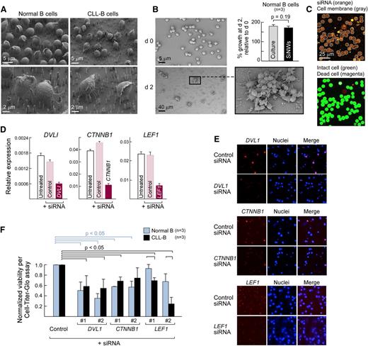 Figure 4. The expression of core Wnt pathway components is required for CLL survival. (A) Scanning electron micrographs (SEMs) of normal CD19+ B (left panels) and CLL-B cells (right panels) atop NWs taken 24 hours after plating. (B) Normal CD19+ B cells can grow and divide on NWs. Normal CD19+ B cells isolated from peripheral blood of healthy adult volunteers were stimulated with IL4 (2 ng/mL) and CD40L (0.1 mg/mLl)28 either in vitro (“culture”) or atop NWs (“SiNWs”) for 48 hours. Cell proliferation was measured using an adenosine triphosphate (ATP)-dependent Cell-Titer Glo assay. Cell growth rate was calculated based on the measurement of ATP amount after 48 hours of stimulation, normalized relative to the day 0 value. (Inset) Scanning electron microscope image showing that proliferating B cells on NWs grow in clusters. (C) Confocal scanning images of Alexa Fluor 546-labeled human anti-vimentin siRNA delivered into CLL-B cells. (Upper panel) siRNA delivery is calculated by manually counting the number of cells that have higher levels of fluorescent siRNAs compared with untransfected controls (not shown here). Alexa Fluor 546-labeled siRNA is shown (orange), whereas cell membranes are shown outlined (gray). (Lower panel) Viability was calculated as a percentage of the number of live cells in the total cells using a live–dead cell staining method. Intact cells (stained with Calcein-AM) are shown (green), whereas the nuclei of dead cells are shown in magenta (stained with EthD-1). (D) Core Wnt pathway components can be silenced in HEK293T using siRNA delivery. Gene expression of Wnt pathway members DVL1, CTNNB1, and LEF1 (relative to glyceraldehyde-3-phosphate dehydrogenase expression) were analyzed by quantitative Taqman RT-PCR using complementary DNA derived from HEK293T cells that were either untransfected (“untreated,” white bars) or transfected for 48 hours with control nontargeting siRNA (“control,” pink bars) or siRNA specific for DVL1, CTNNB1, or LEF1 (dark red bars). (E) Efficient knockdown of protein expression of Wnt pathway members in normal CD19+ and CLL-B cells via NW-mediated siRNA delivery. Representative images of target protein expression, detected by immunofluorescence 48 hours after siRNA delivery using gene-specific antibodies against the target proteins are shown. (F) Median decrease in cell survival (measured by CellTiter Glo) 48 hours after NW-mediated delivery of siRNAs against LEF1, DVL, and CTNNB1 in normal CD19+ (n = 3) and CLL-B (n = 3) compared with silencing using nontargeting siRNA controls (2 different siRNAs per target gene). Percentage of cell survival was normalized to ATP amount at day 0.