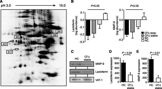 Figure 1. Intrinsic and inflammatory changes to proteins present on CF neutrophil membranes. (A) Comparative analysis of proteins extracted from membranes of ΔF508 homozygous PWCF during an exacerbation (CF∆ exac), the same individuals after exacerbation (CF∆ stable), HC, or non-CF bronchiectasis patient control cells (BC) was performed by 2D-DIGE. Differentially expressed proteins (numbered) illustrated within the representative 2D gel were analyzed by LC-MS/MS. (B) The log protein abundance illustrates persistent down-regulation of lactoferrin and MMP-9 on CFΔ exac and CFΔ stable, compared with HC and BC, samples (P < .05, 1-way ANOVA, n = 6 subjects per group). (C) Neutrophil membrane fractions from HC and CF∆ stable samples were subjected to sodium dodecyl sulfate-polyacrylamide gel electrophoresis and western blot analysis for MMP-9 and lactoferrin. By 2D-DIGE, VAT-1 was found equally expressed between the different membrane types and was therefore used as a loading control. Band intensity for (D) lactoferrin and (E) MMP-9 was quantified by densitometry and normalized to VAT-1 (P = .02 and P = .01, respectively, Student t test, n = 5 subjects per group). All measurements are means ± SEM from biological replicates.